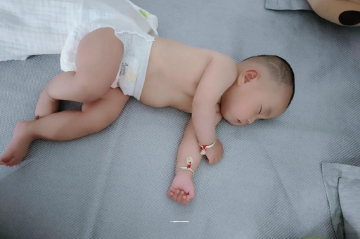 鹿邑宝宝头上长痱子